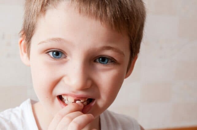 bambino che perde un dente